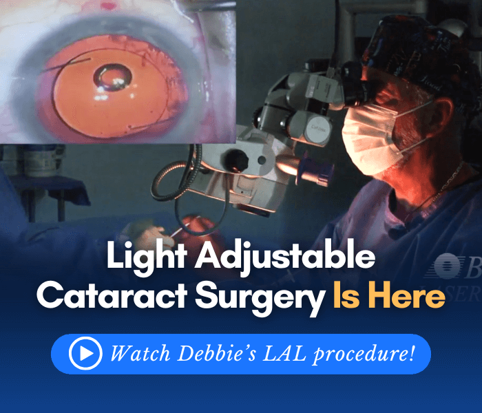 Learn about the Light Adjustable Lens for cataract surgery.